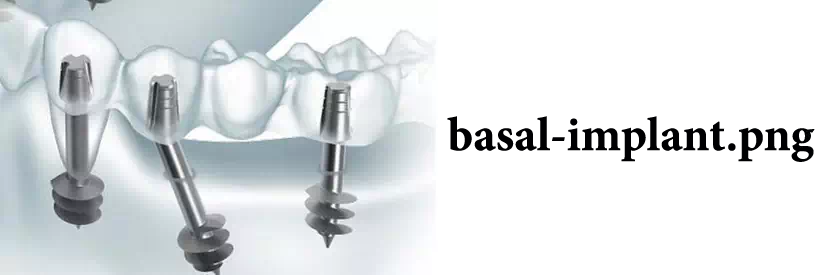 Save the image file with a descriptive name